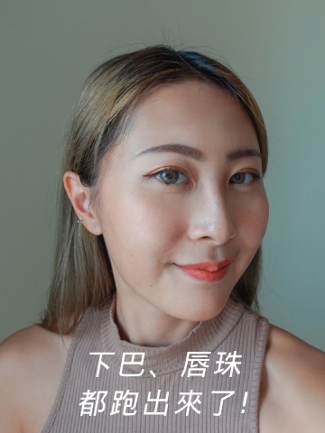 這款玻尿酸打唇珠竟可維持半年！薄唇/頰凹/法令紋/短下巴一起救
