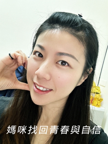 彩虹肉毒 抬頭紋+皺眉紋+咀嚼肌 立即有感！跟大餅臉說掰掰~找回青春與自信！
