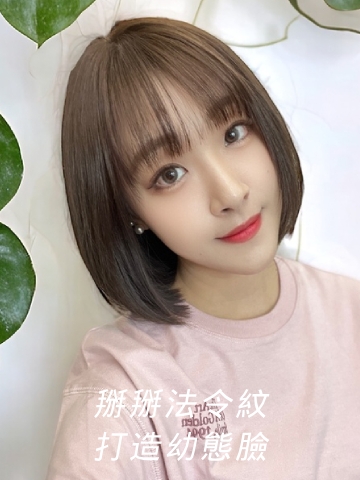 艾玻玻尿酸全紀錄，真實見證、術後注意事項， 打造精緻自然幼態臉