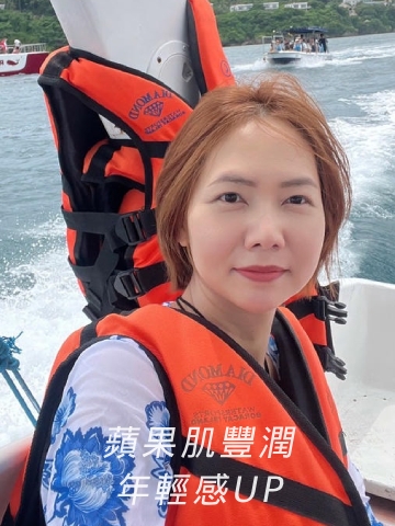 妮芙蕾膠原蛋白增生，重拾緊緻彈潤∣淨妍醫美桃園分院