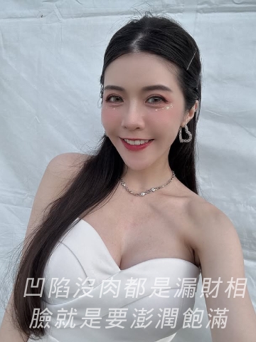 臉凹沒肉都是漏財相，臉就是要澎潤飽滿｜妮芙蕾膠原蛋白增生劑