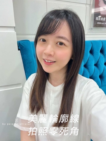 新竹醫美推薦｜三次Onda Pro 超微波完整療程全紀錄－美麗輪廓線，拍照零死角