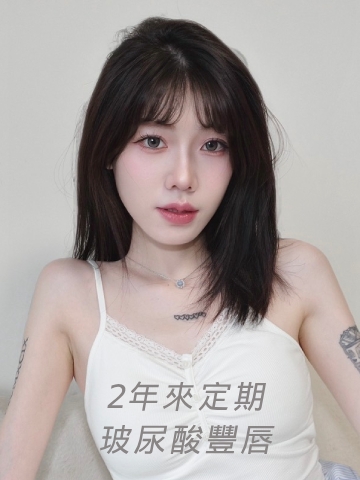 已經持續2年定期打玻尿酸豐唇，艾玻玻尿酸打造嘟嘟唇，維持度很好