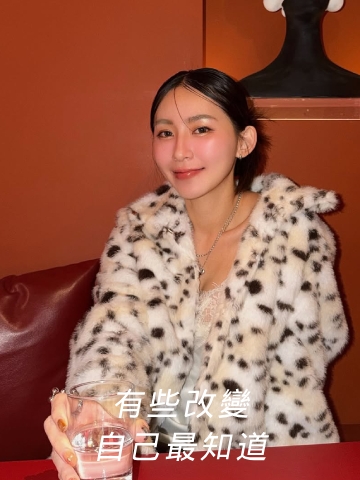 肉毒咀嚼肌放鬆，讓原本的輪廓看起來更順，喜歡這樣剛剛好的狀態