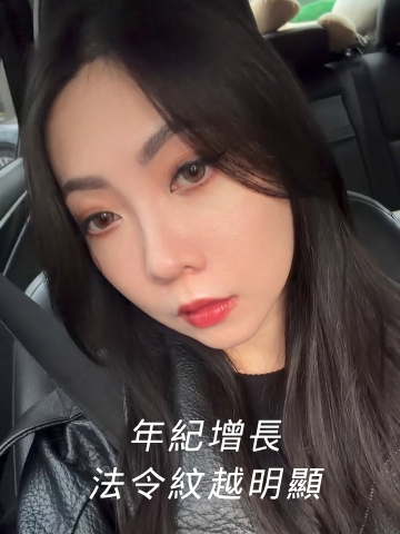 法令紋隨著年紀增長越來越明顯，艾玻玻尿酸法令紋效果非常滿意