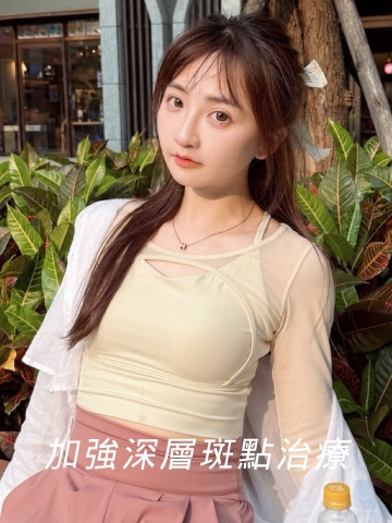 皮秒雷射治療深層斑點很有效，上妝服貼、膚色均勻明亮