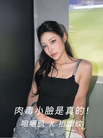 肉毒小臉是真的！真的是我目前唯一敢做不後悔的醫美！