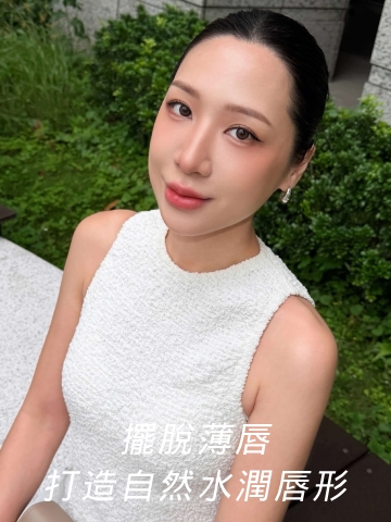 艾玻玻尿酸豐唇｜擺脫薄唇，打造自然水潤唇形