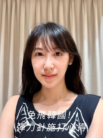 免飛韓國！ Doublyx EVO 彈力針施打心得　在桃園淨妍醫美診所啟動肌底修復力