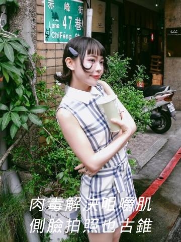 娜柏塔肉毒｜拍照不用喬角度，咀嚼肌肉毒超有感！