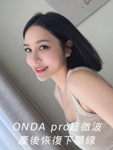 ONDA pro超微波｜產後調理好選擇，下顎線又回來了！