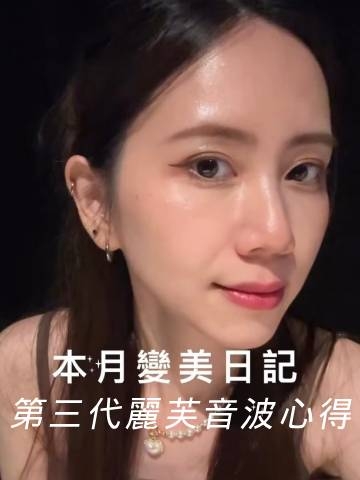 第三代麗芙音波｜只擦保養品不夠！消除頸紋選音波，雙下巴也有效