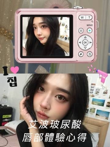 艾波玻尿酸｜小小的嘴唇調整，讓唇妝精緻滿分！