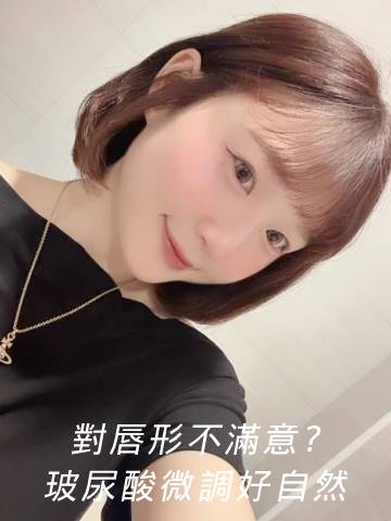 艾波玻尿酸｜修飾脣形好簡單，妝容馬上變精緻