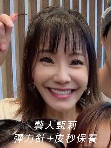 彈力針+皮秒雷射｜上妝時間長肌膚好乾燥，藝人甄莉選擇淨妍彈力針深層補水