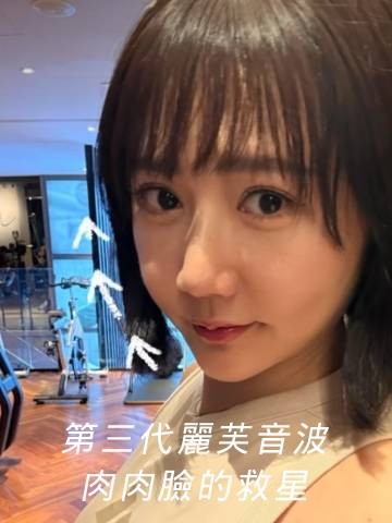 第三代麗芙音波｜肉肉臉的救星，臉部慢慢緊緻的驚喜