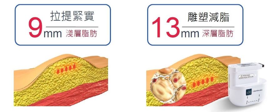 戰斧音波有助於消除腹圍平均約2公分