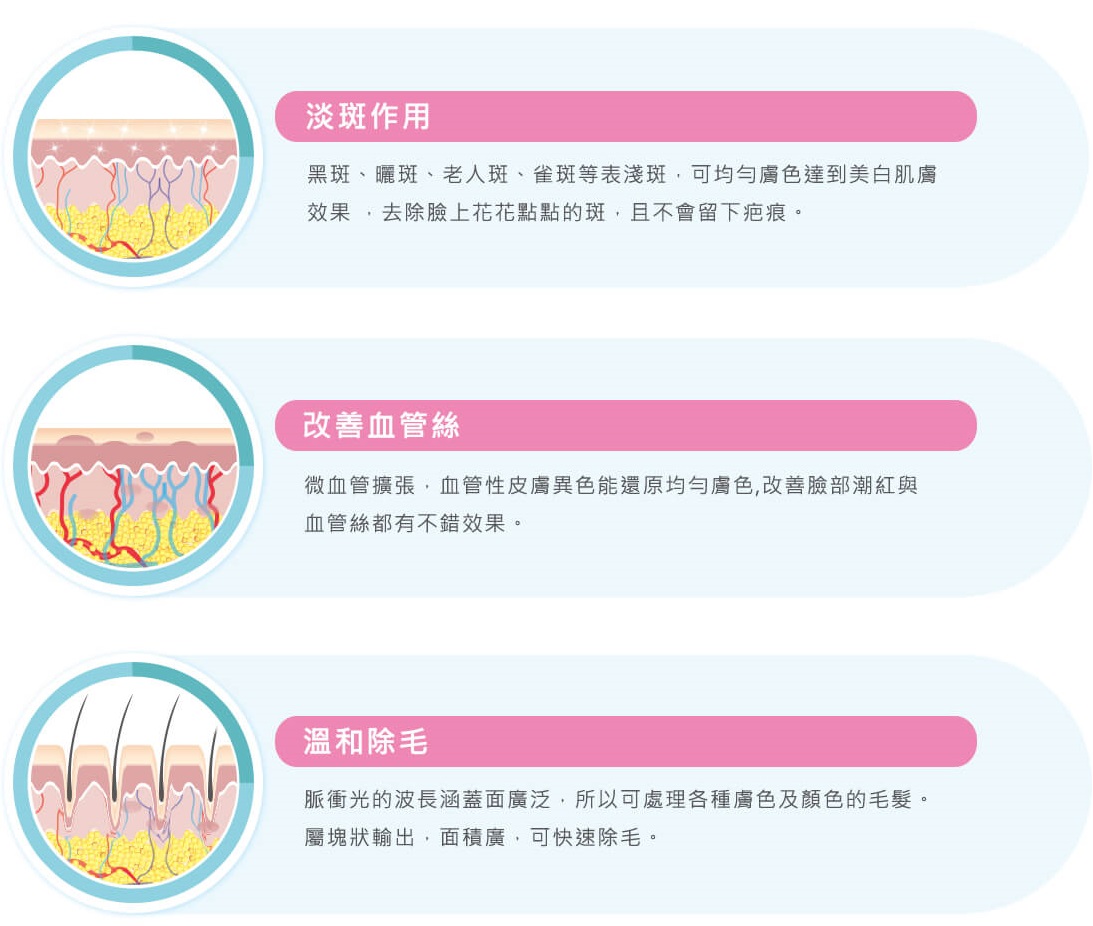 脈衝光雷射除斑美白改善青春痘除毛效果佳