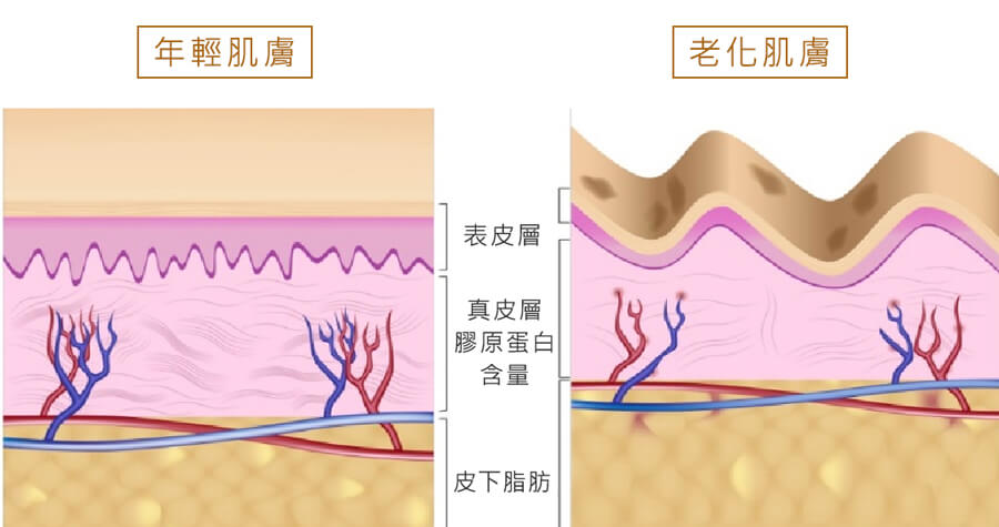 年輕肌膚(左)和老化肌膚(右)相比，真皮層膠原蛋白含量較高。