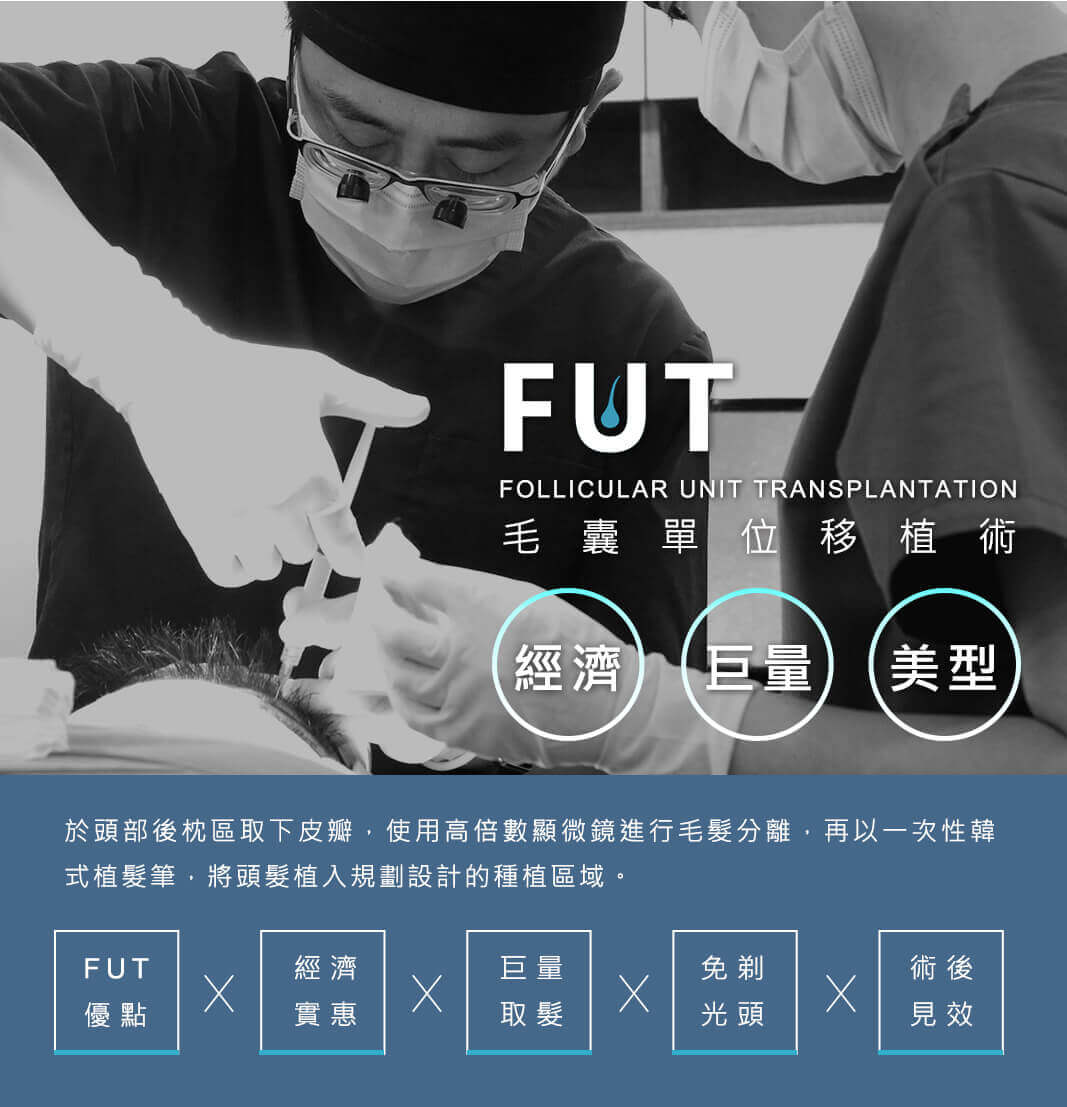 FUT毛囊單位移植術