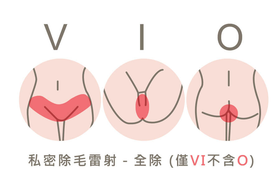 私密處雷射除毛部位