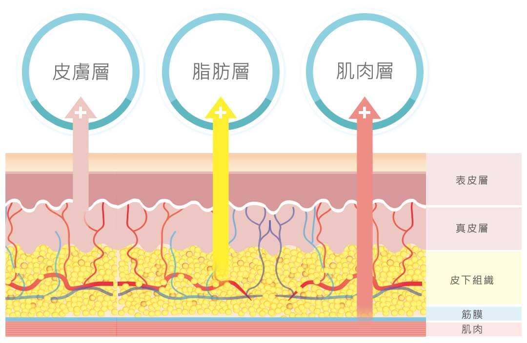 內視鏡拉皮