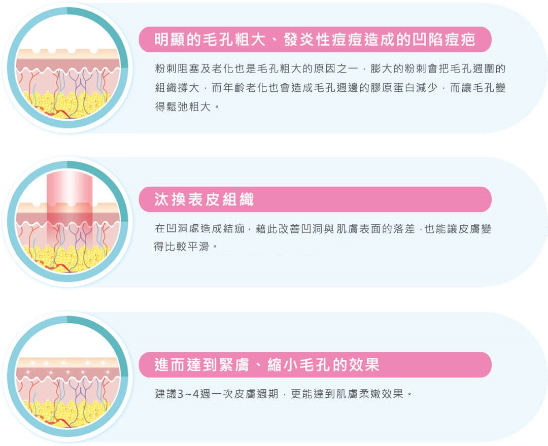 冷光雷射使皮膚新生膠原蛋白重組效果