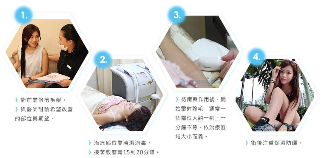 雷射除毛流程說明