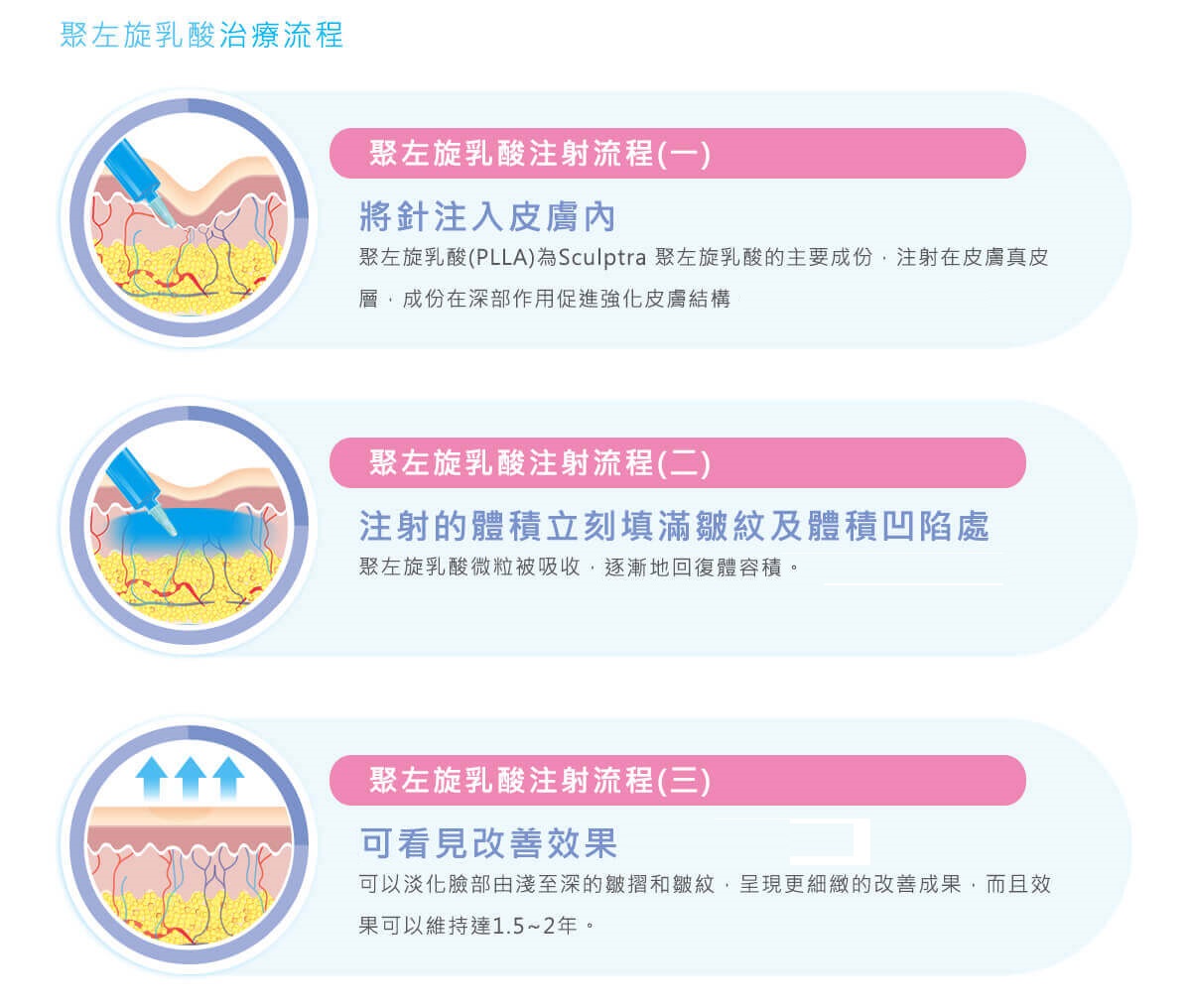 舒顏萃又稱童顏針,療程效果圖示
