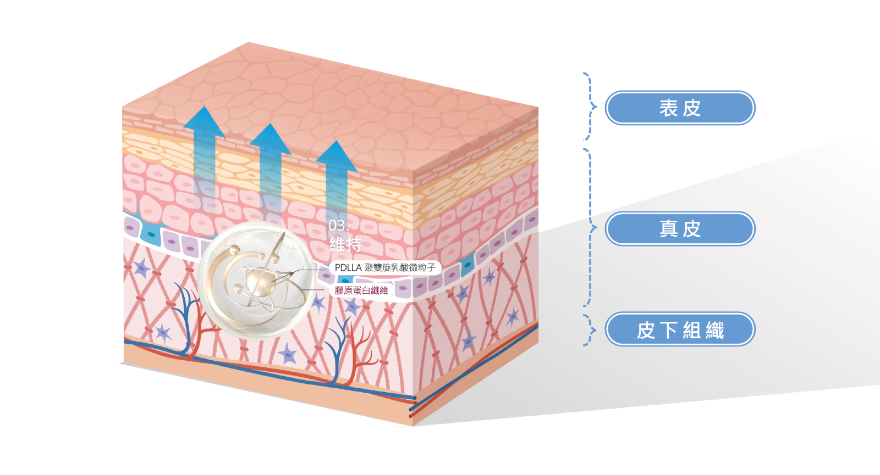 人體吸收後，PDLLA會刺激膠原蛋白再生，讓肌膚漸漸恢復飽滿、有彈性的狀態。