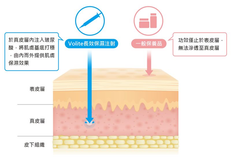 Volite長效保濕注射V.S一般保養品