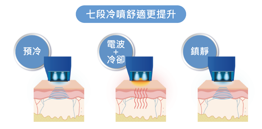 迎接歲月挑戰就靠它！  醫：十蓓電波緊實效果佳