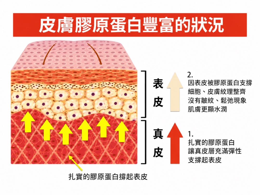 歲月的殺豬刀讓膠原蛋白快速流失