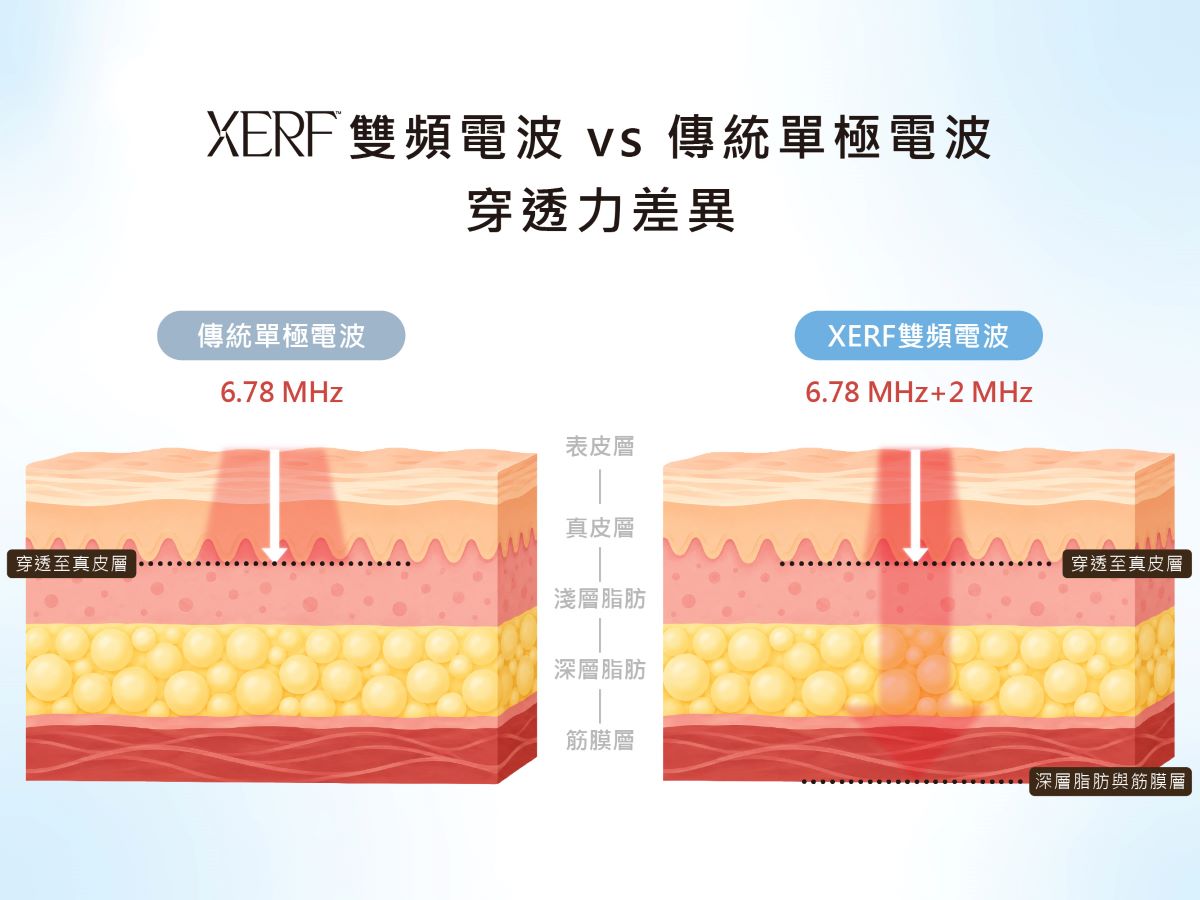 XERF雙頻電波 vs. 傳統單極電波，有穿透力差異？