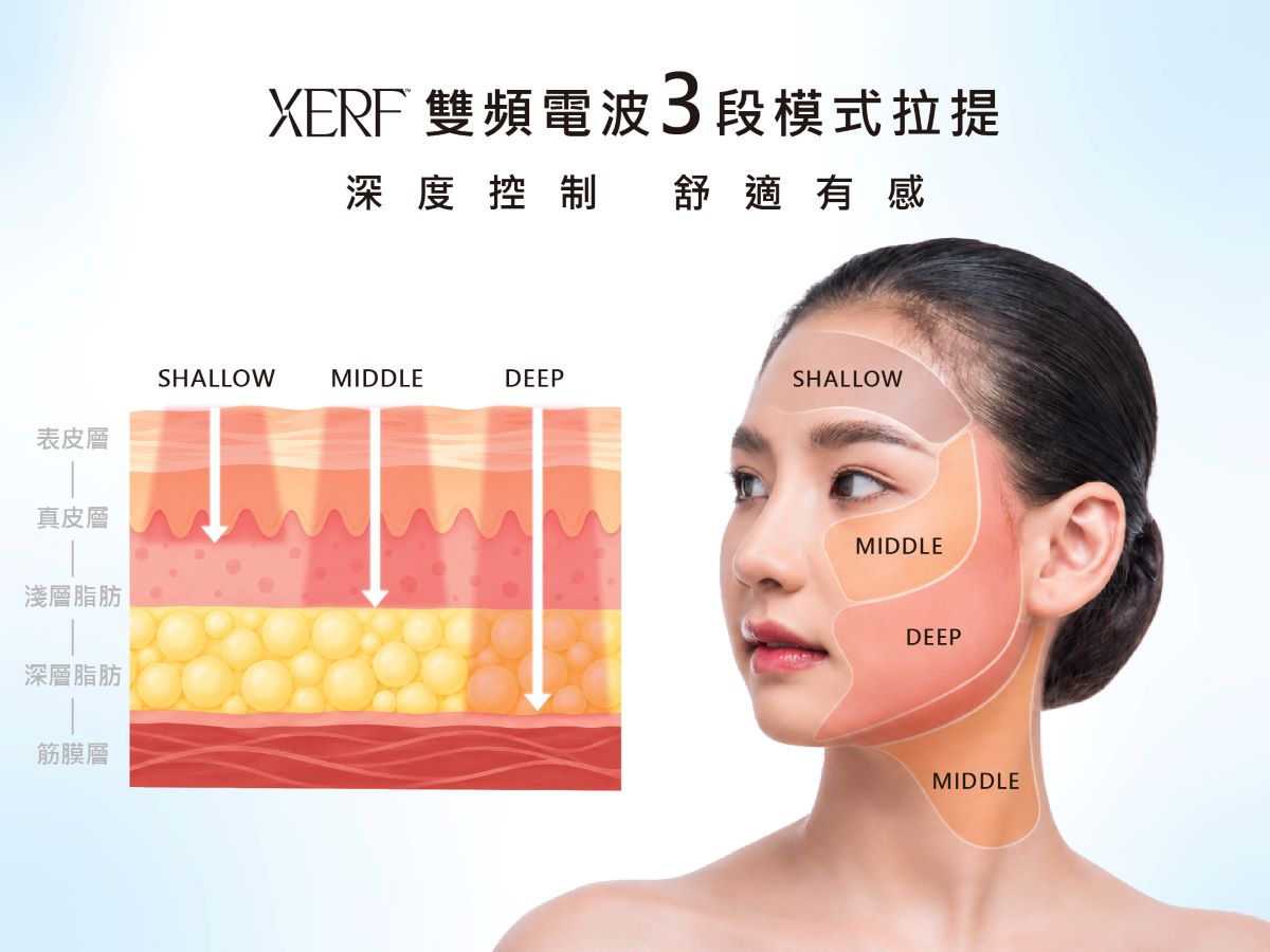 XERF 雙頻電波3段模式拉提部位｜深度控制、舒適有感