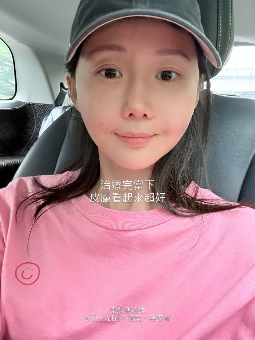 曙光瓶體驗aesPlla｜圓潤有福氣的臉，逐漸消瘦黯淡無光。改善頰凹，有感的澎潤、拉提