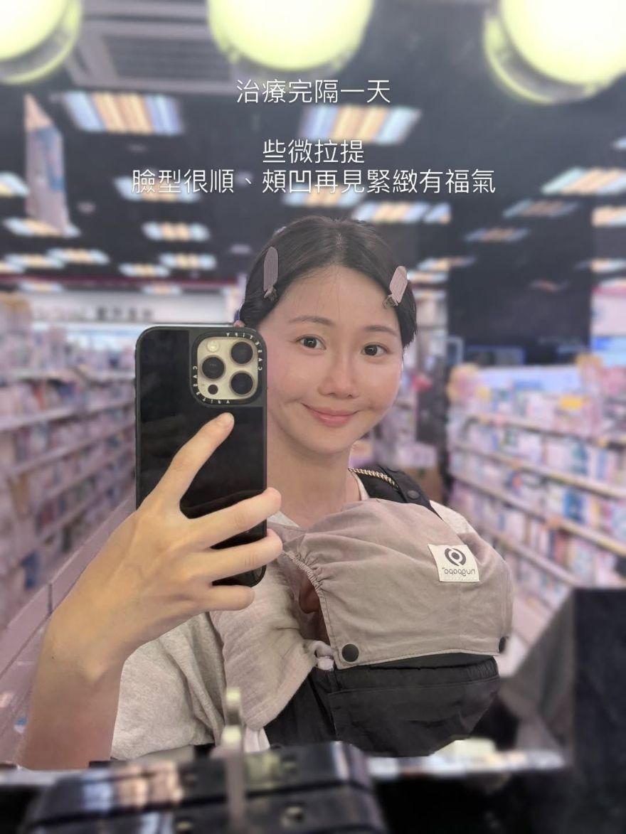 曙光瓶體驗aesPlla｜圓潤有福氣的臉，逐漸消瘦黯淡無光。改善頰凹，有感的澎潤、拉提