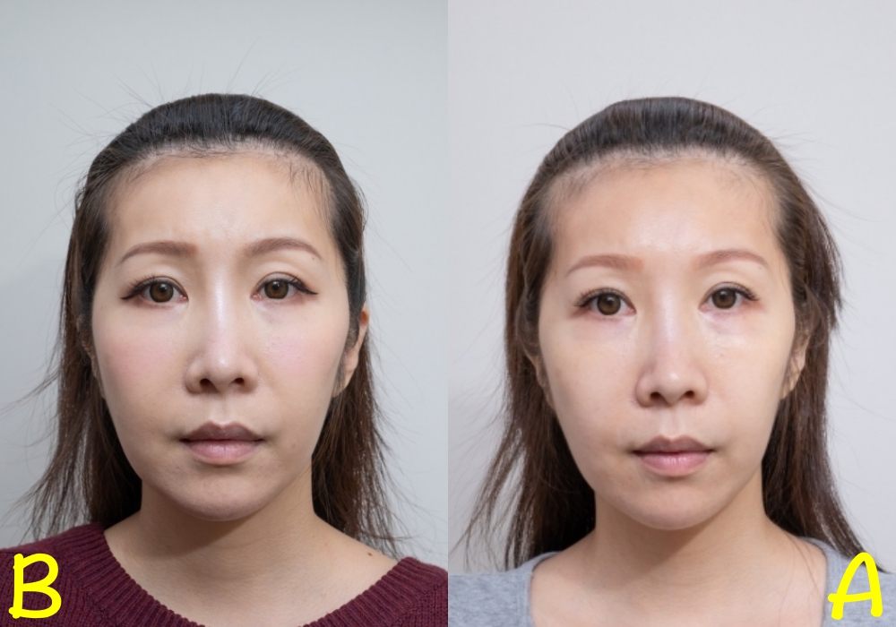 韓國薇貝拉VIVABELLA。如同魔法般找回膠原蛋白-讓我年輕美麗