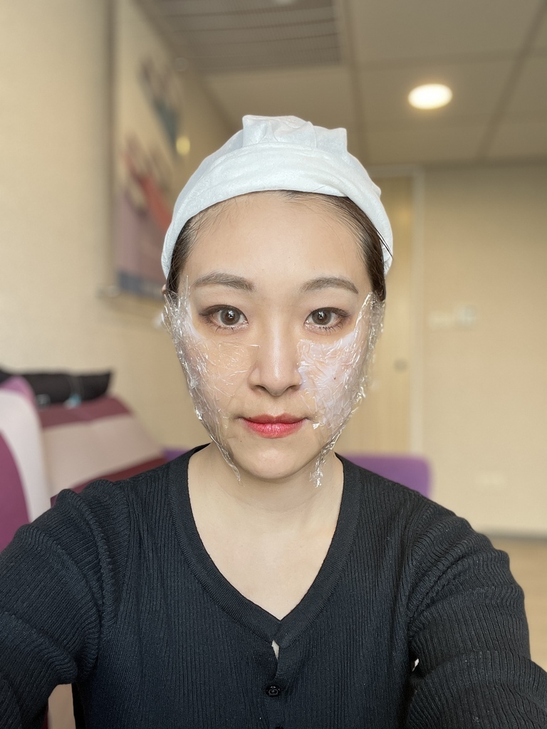 艾玻玻尿酸全紀錄，真實見證、術後注意事項， 打造精緻自然幼態臉