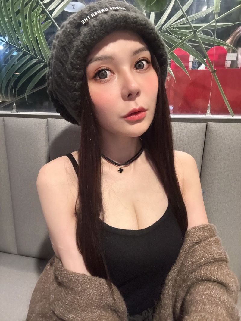 艾玻玻尿酸豐唇,改善上唇偏薄,影響人中看起來變長的困擾