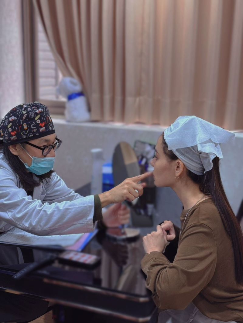 艾玻玻尿酸豐唇,改善上唇偏薄,影響人中看起來變長的困擾