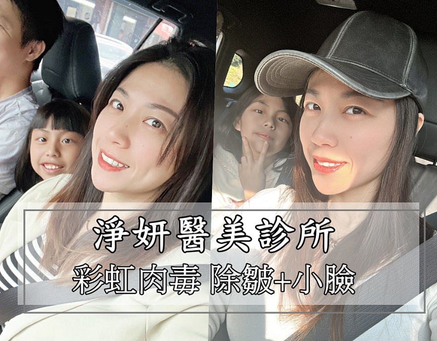 彩虹肉毒抬頭紋+小臉 立即有感! 跟大餅臉說掰掰~找回青春與自信