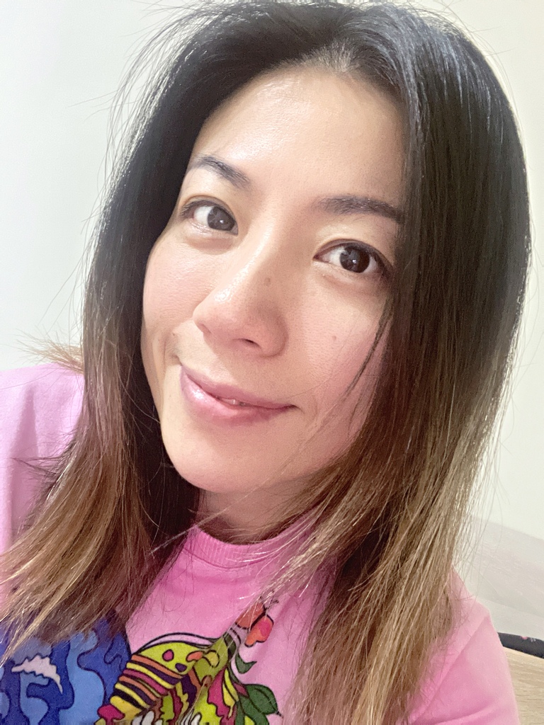 淨妍醫美診所 彩虹肉毒抬頭紋+小臉 立即有感! 跟大餅臉說掰掰~找回青春與自信