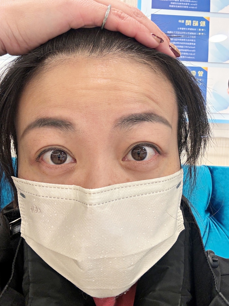 淨妍醫美診所 彩虹肉毒抬頭紋+小臉 立即有感! 跟大餅臉說掰掰~找回青春與自信