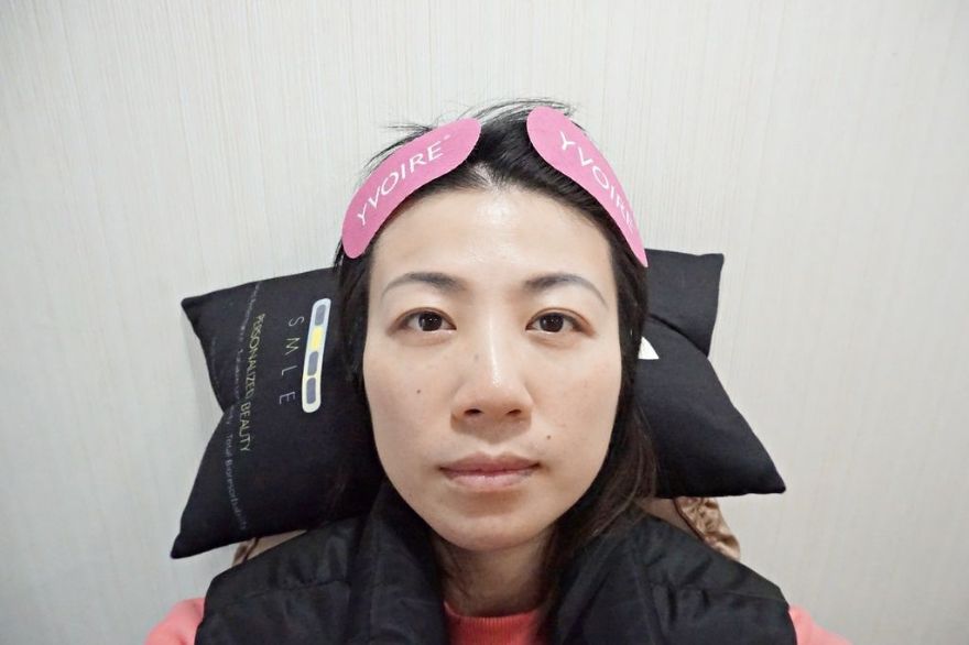 淨妍醫美診所 彩虹肉毒抬頭紋+小臉 立即有感! 跟大餅臉說掰掰~找回青春與自信