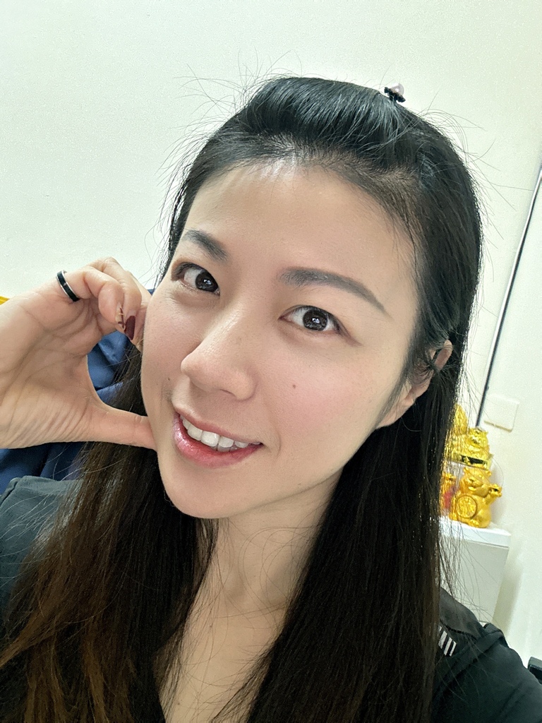 淨妍醫美診所 彩虹肉毒抬頭紋+小臉 立即有感! 跟大餅臉說掰掰~找回青春與自信!