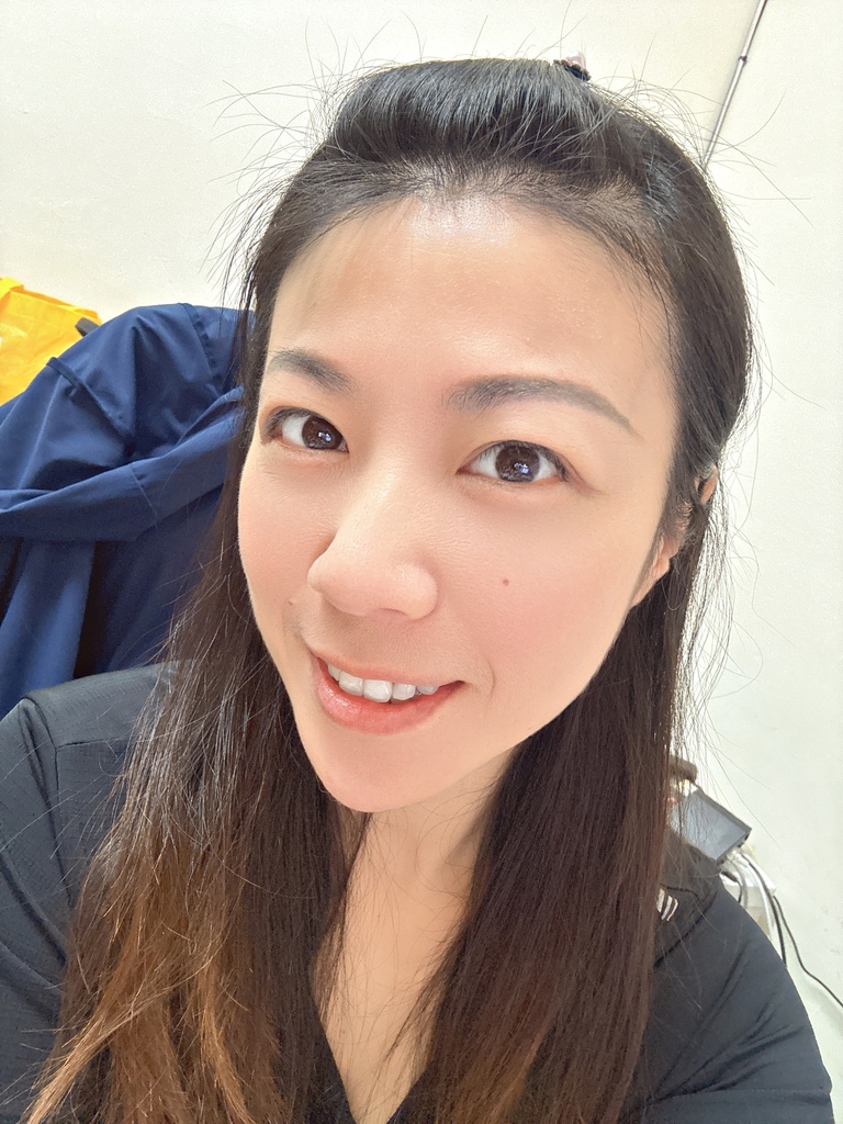 淨妍醫美診所 彩虹肉毒抬頭紋+小臉 立即有感! 跟大餅臉說掰掰~找回青春與自信!