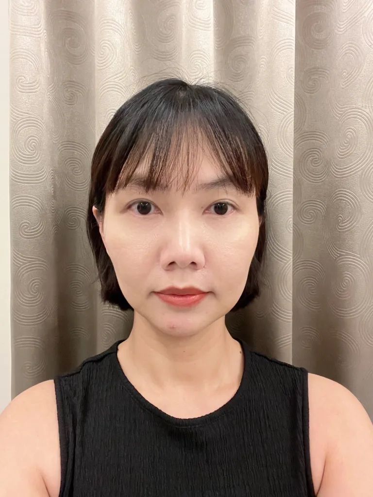 神力拉提 MINT LIFT秘特拉提線 埋線拉提效果超讚 │ 板橋醫美
