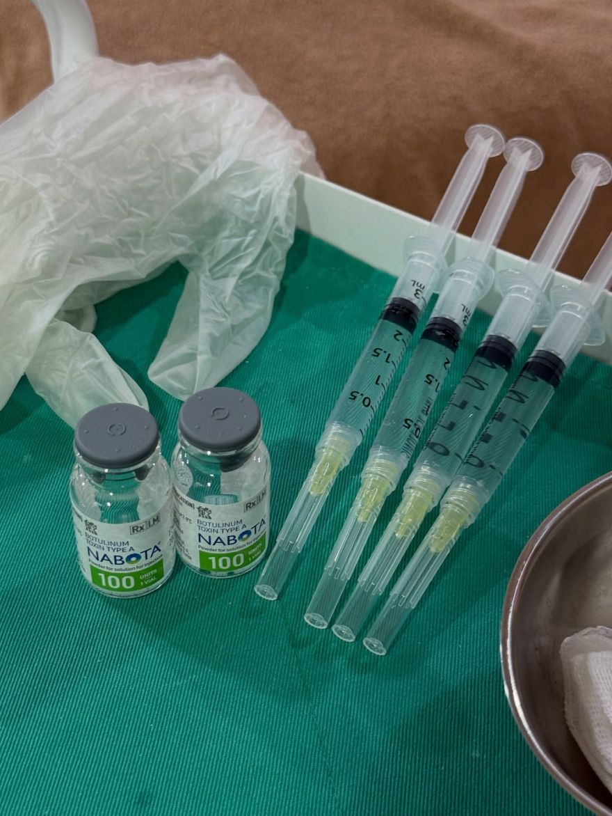 新莊醫美｜打造精緻直角肩，肉毒肩膀一併改善了圓背和肩頸緊繃