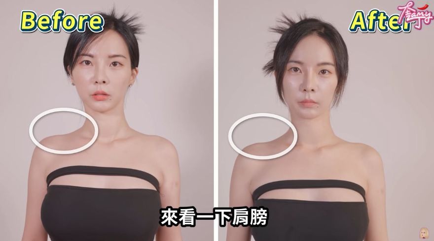 奎丁彩虹肉毒肩膀放鬆肌肉